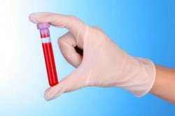  Анализ крови на наличие антител 