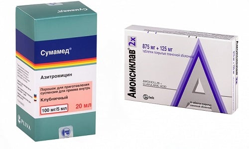 Антибиотики из категории макролидов и пенициллинов - Сумамед и Амоксиклав, считаются самыми безопасными и эффективными